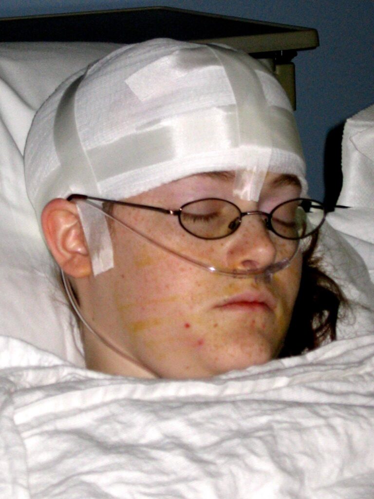 Founder, Amanda Vogt, in recovery from brain surgery.